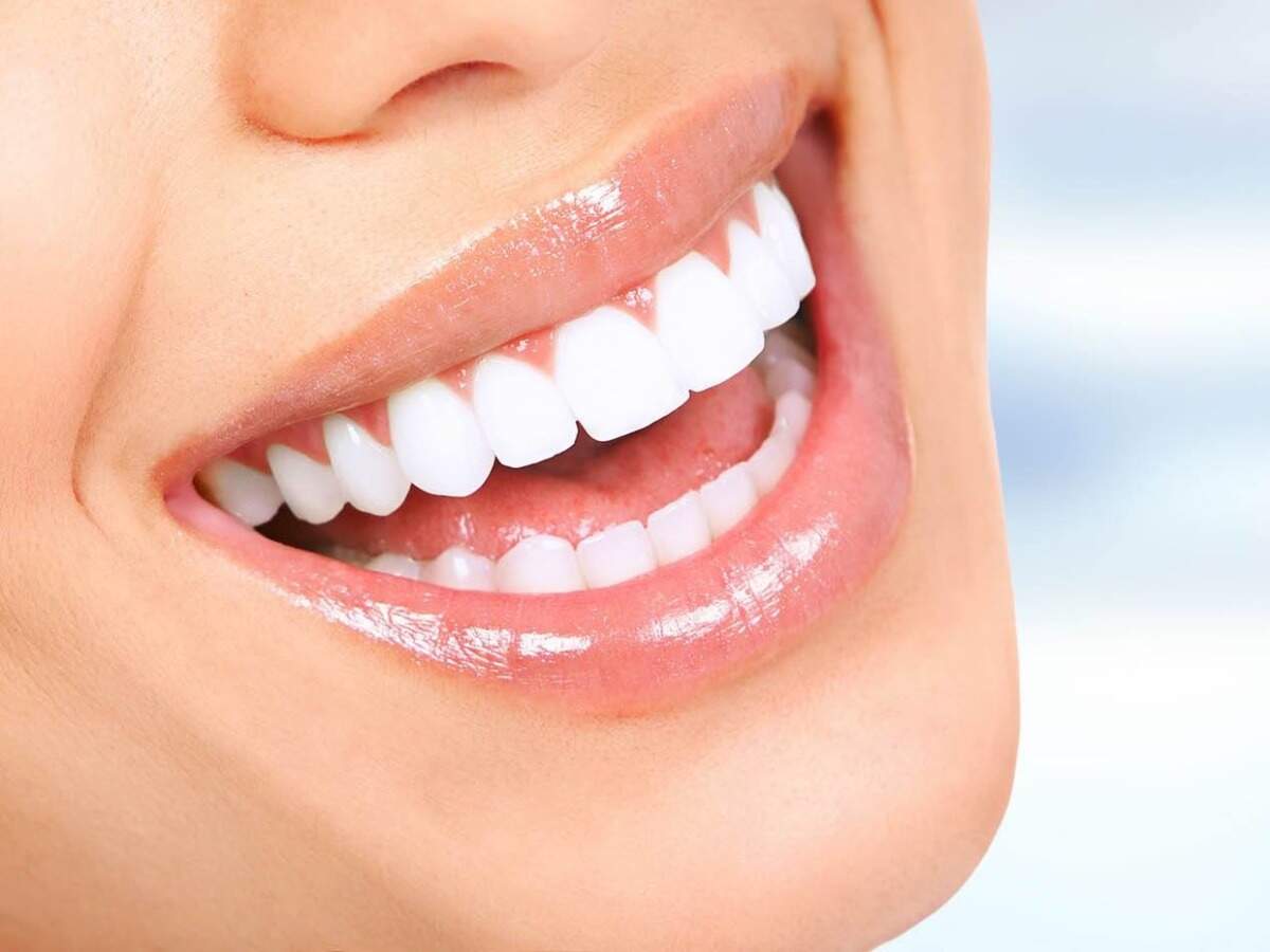 Teeth Whitening Side Effects Teeth whitening could lead to tooth decay